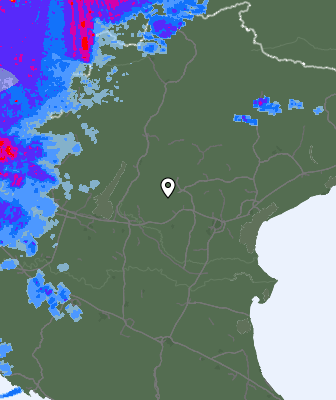 Radar