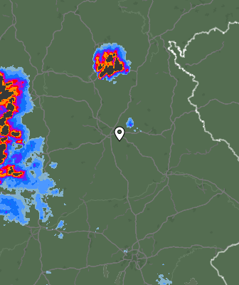 Radar