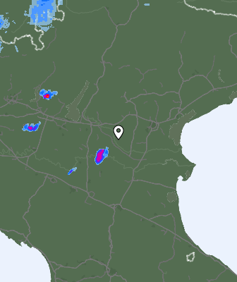Radar