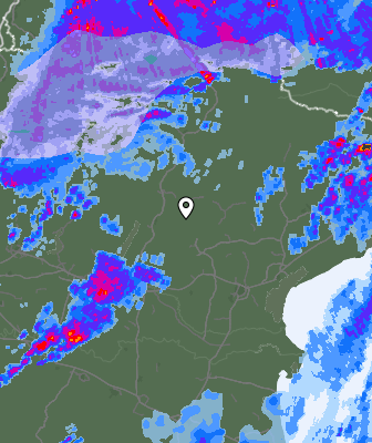 Radar
