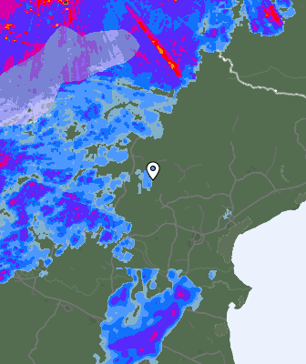 Radar