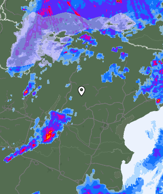 Radar