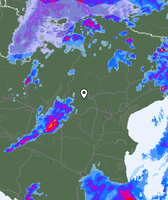Radar