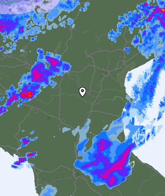 Radar