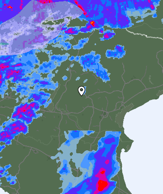 Radar