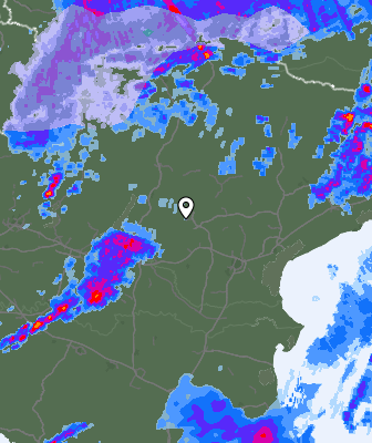 Radar