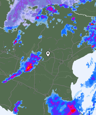 Radar