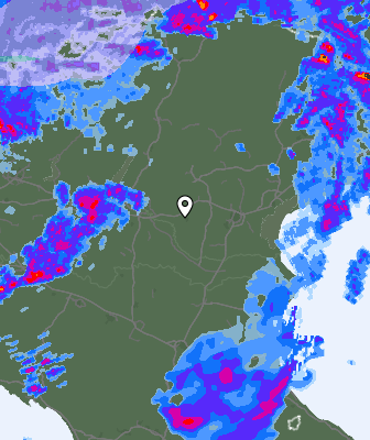 Radar
