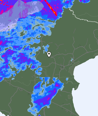 Radar