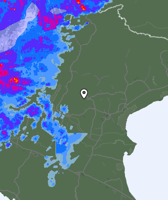 Radar