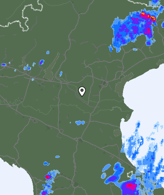 Radar