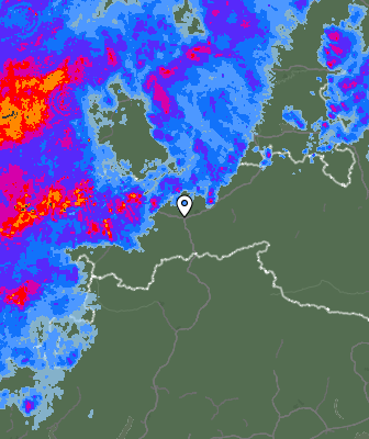 Radar