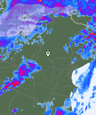 Radar