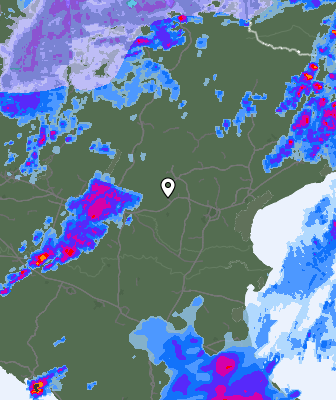 Radar