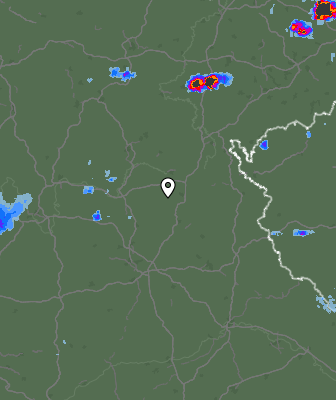 Radar