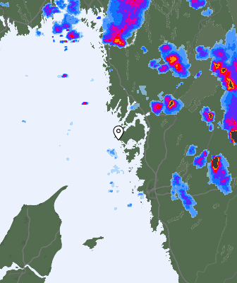 Radar