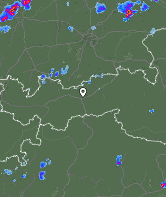Radar