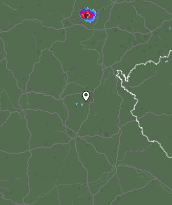 Radar