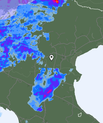 Radar