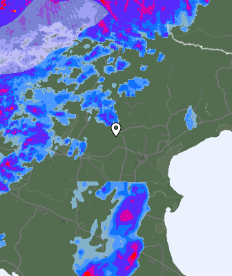 Radar