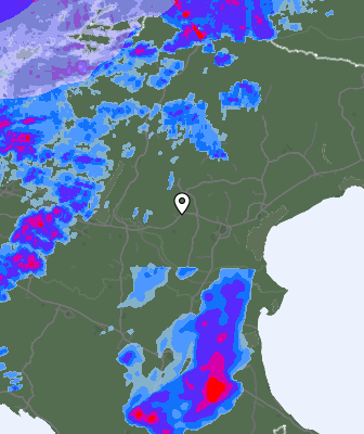 Radar