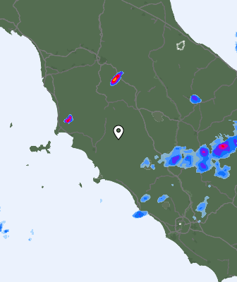 Radar