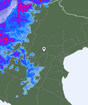 Radar