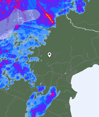 Radar
