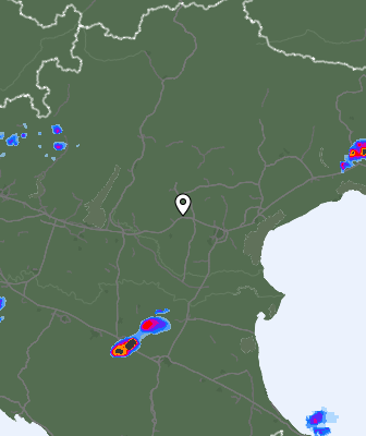 Radar