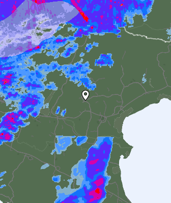 Radar