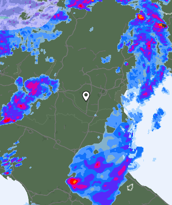 Radar