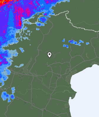 Radar