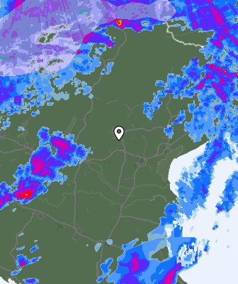 Radar