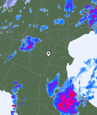 Radar