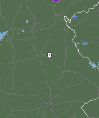 Radar