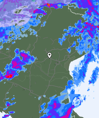Radar