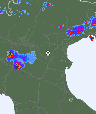 Radar