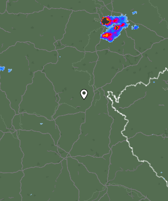 Radar