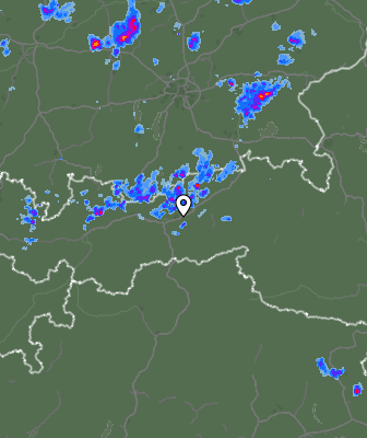 Radar