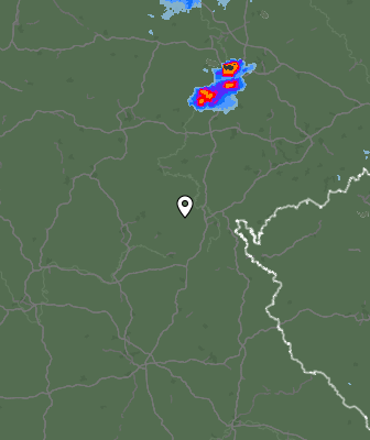 Radar