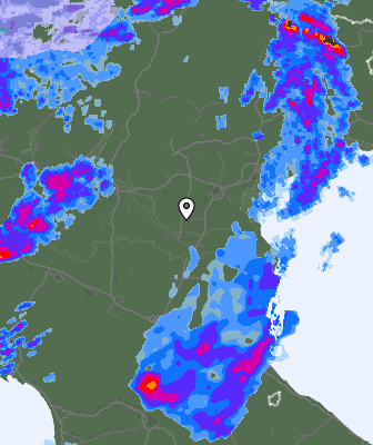 Radar