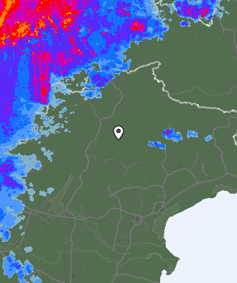 Radar