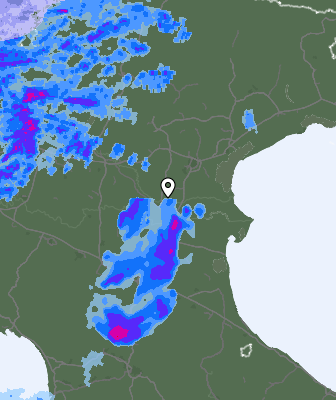Radar