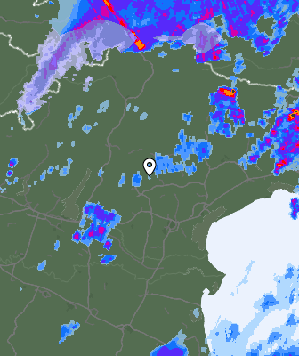 Radar