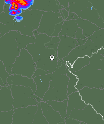 Radar