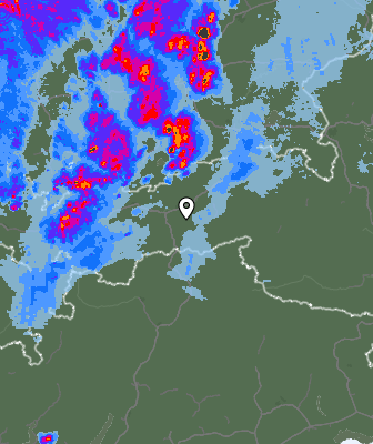 Radar