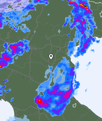 Radar
