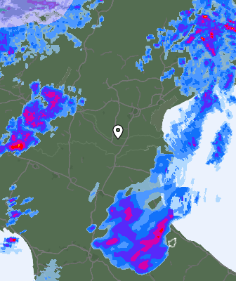 Radar