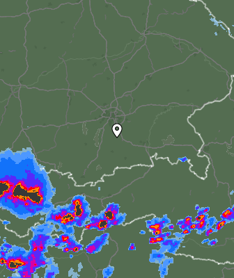 Radar