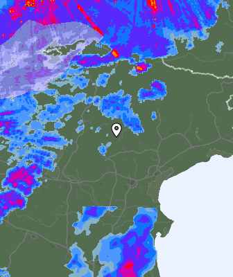 Radar